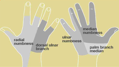 Hand Numbness Omaha Nebraska